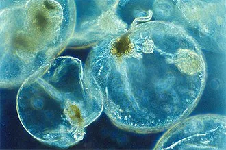 Dinoflagellates